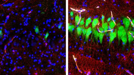 Immunfluoreszenz von Nervenzellen, zehn Stunden nach dem Tod. Die Aufnahme rechts zeigt eine gewisse Aktivität. 