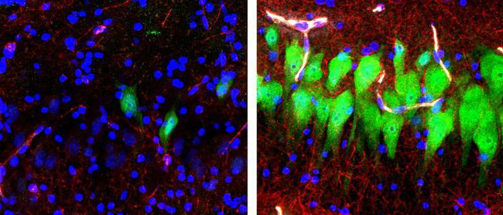 Immunfluoreszenz von Nervenzellen, zehn Stunden nach dem Tod. Die Aufnahme rechts zeigt eine gewisse Aktivität.