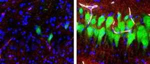 Immunfluoreszenz von Nervenzellen, zehn Stunden nach dem Tod. Die Aufnahme rechts zeigt eine gewisse Aktivität. 