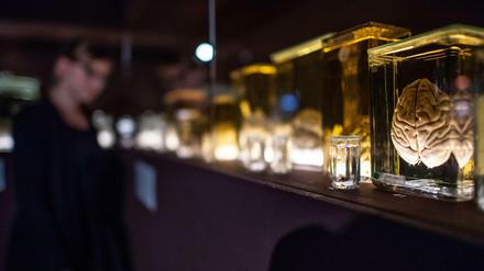 Foto der Ausstellung "Das Gehirn - Intelligenz, Bewusstsein, Gefühl", die im Naturkundemuseum in Münster zu sehen ist. 