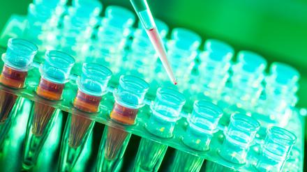 Bislang müssen Ärzte Gewebeproben nehmen, um Brustkrebs zu diagnostizieren. Ein Bluttest (Liquid Biopsy), der krebstypische Moleküle nachweist, könnte Frauen das ersparen, ist aber noch nicht ausgereift.