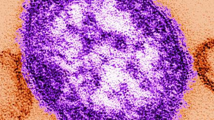 Elektronenmikroskopische Aufnahme eines Masernvirus. 