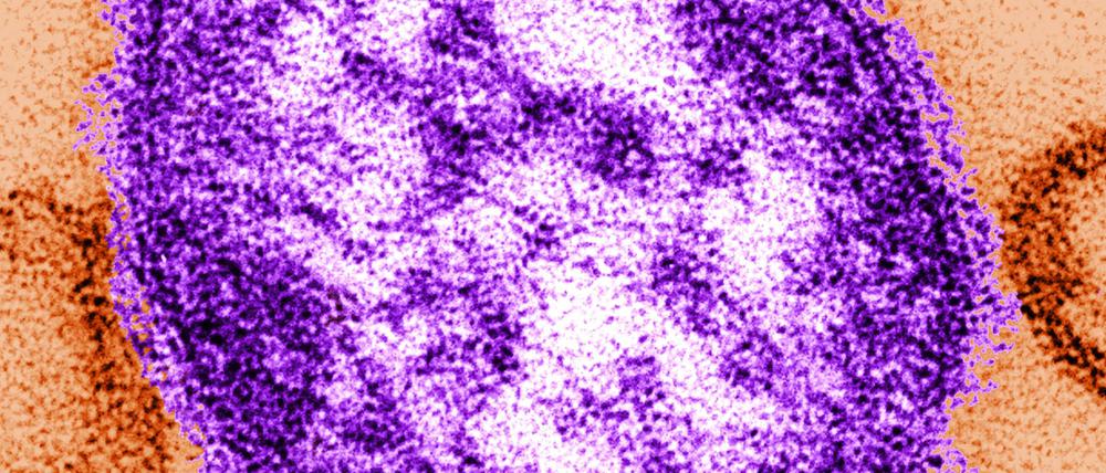 Elektronenmikroskopische Aufnahme eines Masernvirus.