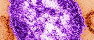Elektronenmikroskopische Aufnahme eines Masernvirus. 