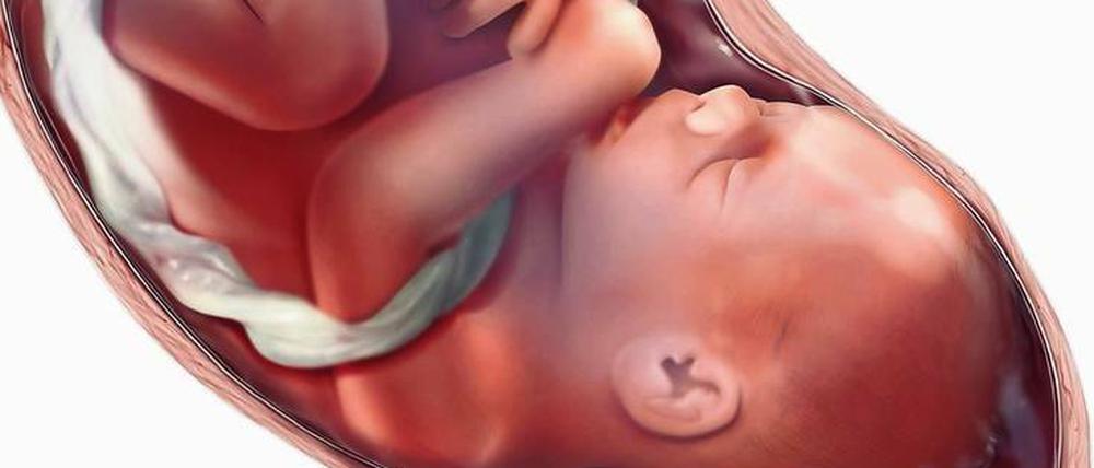Für Frauen ohne Gebärmutter ist die Transplantation eine Hoffnung.