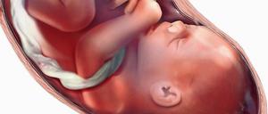 Für Frauen ohne Gebärmutter ist die Transplantation eine Hoffnung.
