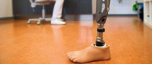 Ersatz-Los. Es gibt die ausgeklügeltsten Prothesen, die Aussehen und Bewegung von Füßen oder Beinen täuschend echt nachahmen. Doch oft bleibt das beste Kunstbein ungenutzt, weil die Hürden für Patienten zu hoch sind, um den Umgang damit zu lernen.