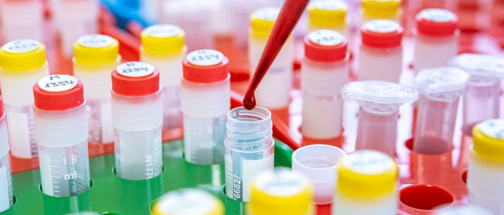 Unter Laborbedingungen. Ein Bluttest kostet oft viel Zeit.