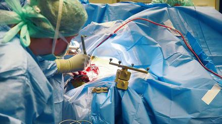 Einige Kliniken bieten Operationen an, obwohl ihnen die Erfahrung dafür fehlt.
