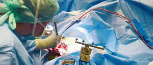 Einige Kliniken bieten Operationen an, obwohl ihnen die Erfahrung dafür fehlt.