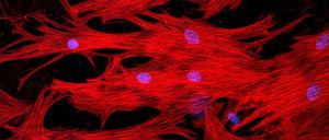 Herzmuskelzellen interagieren mit vielen anderen Zellen. Wie genau und welche das sind, das wollen Forscher jetzt untersuchen.