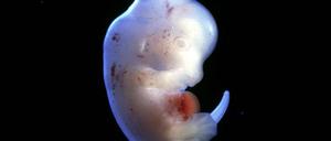 Chimärenexperiment: Ein Mausorgan in einem Rattenembryo 