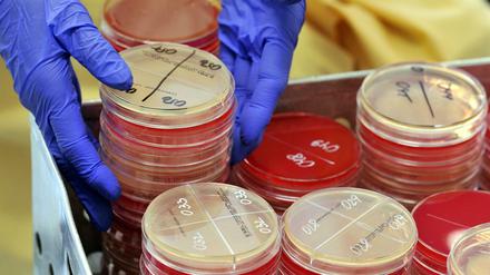 Resistente Klebsiella-Bakterien hatten zuletzt zwischen 2010 und 2012 an der Uniklinik in Leipzig eine lange Erkrankungsserie ausgelöst, in deren Verlauf 30 Menschen starben. 