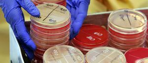 Resistente Klebsiella-Bakterien hatten zuletzt zwischen 2010 und 2012 an der Uniklinik in Leipzig eine lange Erkrankungsserie ausgelöst, in deren Verlauf 30 Menschen starben. 