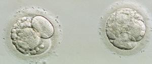 Vier Tage alte menschliche Embryonen unterscheiden sich von Affenembryonen auf den ersten Blick nicht.