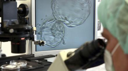 In-vitro-Fertilisation (IVF) unterm Mikroskop.