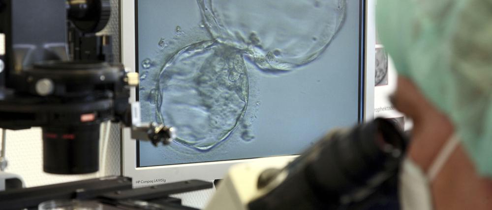 In-vitro-Fertilisation (IVF) unterm Mikroskop.