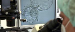 In-vitro-Fertilisation (IVF) unterm Mikroskop.