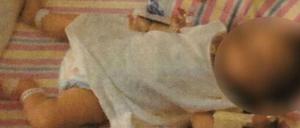 Das Baby war deutlich unterernährt und wog mit 19 Monaten nur knapp fünf Kilogramm.