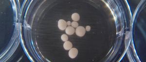 Forscher können erbsengroße Gehirn-Organoide züchten. Ob deren elektrische Nervenzellaktivität den Hirnströmen von Frühchen ähneln soll, ist offen. -