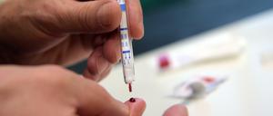 Ein junger Mann führt einen HIV-Selbsttest durch.