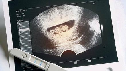 Der Test mit Ultraschall (Sonografie) kommt während der Schwangerschaft dreimal zum Einsatz: im 3., 6. und 8. Monat. 