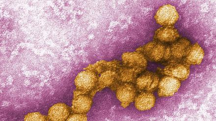 Das West-Nil-Virus unter dem Elektronenmikroskop.
