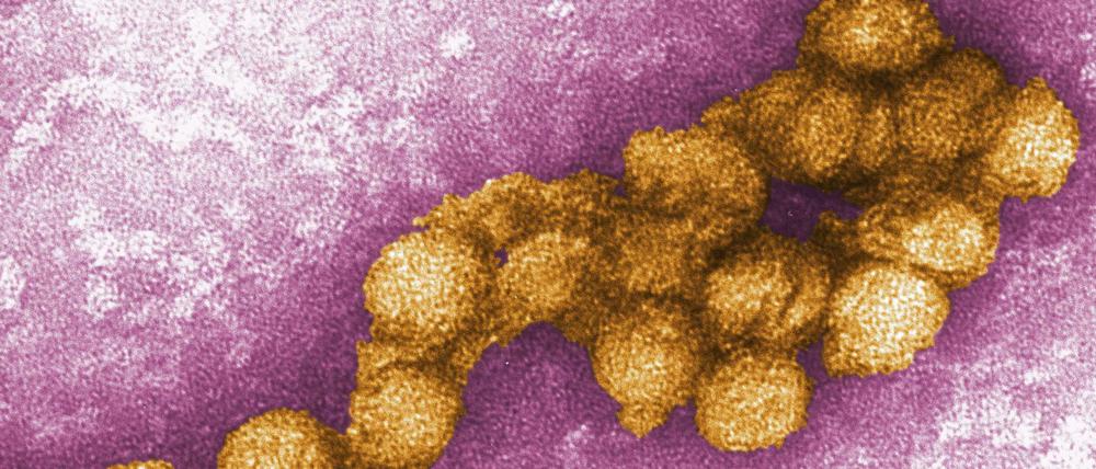 Das West-Nil-Virus unter dem Elektronenmikroskop.