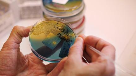 In Gewebeproben eines Hundes suchen Wissenschaftler nach Hinweisen auf den Erreger der Durchfälle. Ein sonst eher harmloses Bakterium könnte die Ursache sein.