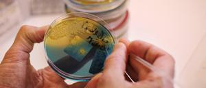 In Gewebeproben eines Hundes suchen Wissenschaftler nach Hinweisen auf den Erreger der Durchfälle. Ein sonst eher harmloses Bakterium könnte die Ursache sein.