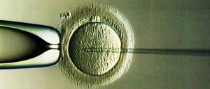 Die Neuregelung zur künstlichen Befruchtung ist Teil des Bioethik-Gesetzes.