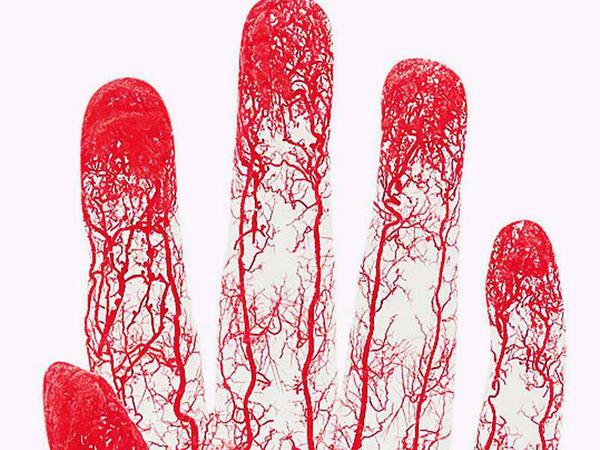 Ein anatomisches Präparat der Blutgefäße in einer menschlichen Hand.