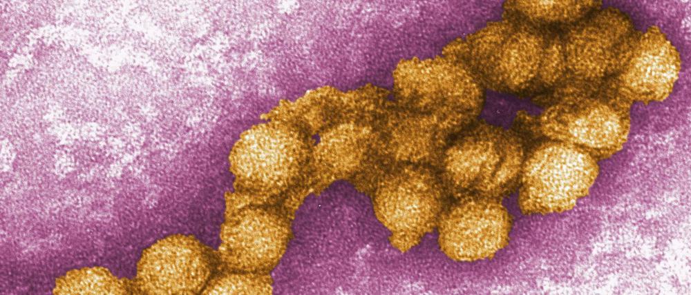 Das West-Nil-Virus unter dem Elektronenmikroskop. 