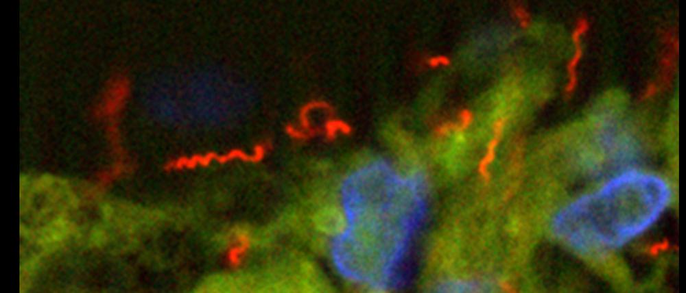 Das Bakterium Treponema pallidum, der Erreger der Syphilis.