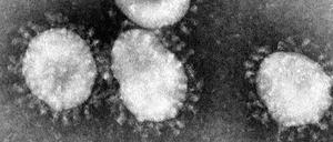 Vier Exemplare eines Coronavirus unter dem Elektronen-Mikroskop (anderer Typ als der jetzt entdeckte, Aufnahme vom April 2003). Die Ausbreitung einer bislang mysteriösen Lungenkrankheit in der zentralchinesischen Metropole Wuhan könnte auf ein neuartiges Coronavirus zurückgehen.