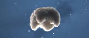 Ist das die erste lebende Maschine der Welt? Forscher haben mit Hilfe eines Computers einen Roboter aus Froschzellen zusammengebastelt.