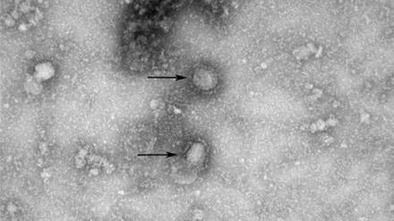 Auslöser der Reihe von Lungenentzündungen in Wuhan in der chinesischen Provinz Hubei ist offenbar ein SARS-Virus, das zur Gruppe der Coronaviren gehört. 