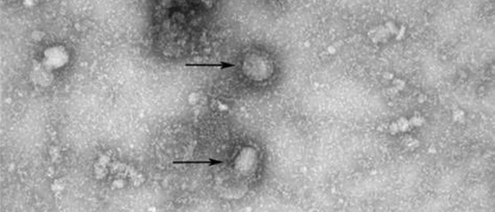 Auslöser der Reihe von Lungenentzündungen in Wuhan in der chinesischen Provinz Hubei ist offenbar ein SARS-Virus, das zur Gruppe der Coronaviren gehört. 