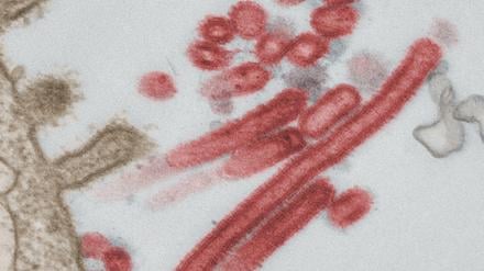 Influenza-Viren aus menschlichem Lungengewebe.
