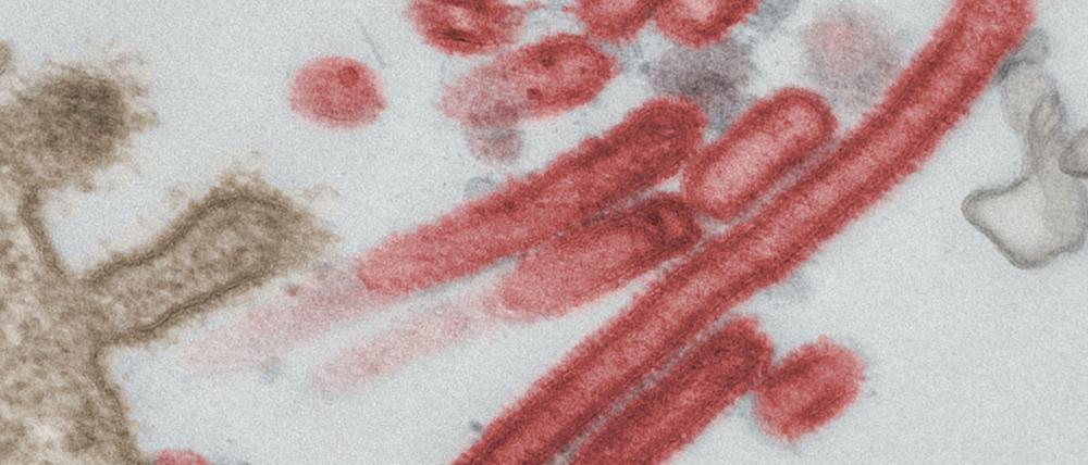 Influenza-Viren aus menschlichem Lungengewebe.