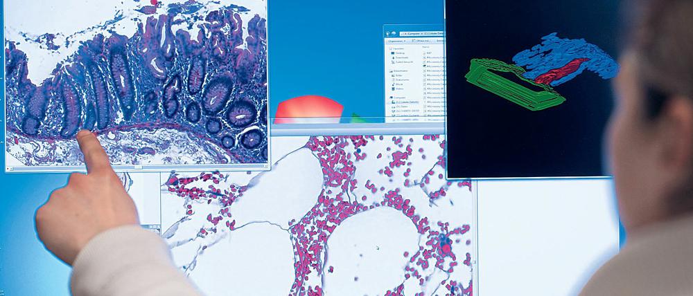 Ein Mitarbeiter der Universitätsklinik Charité in Berlin an einem Computerbildschirm auf eine Darstellung einer eingescannten Probe eines Stück Gewebes.