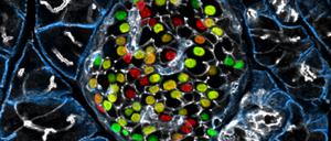 Verschiedene Zelltypen im Gewebe der Bauchspeicheldrüsen produzieren Insulin.