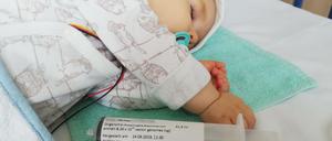 Der einjährige Michael schläft, während er eine Injektion mit dem Genpräparat Zolgensma.