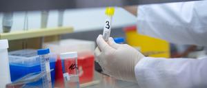 Das Vertrauen der Deutschen in die Gesundheitsbehörden leidet unter der Coronovirus-Krise.