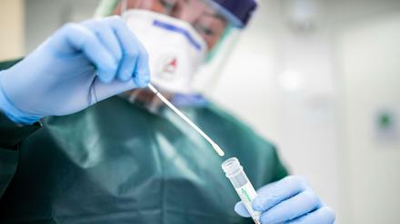 Eine Mitarbeiterin im Krankenhaus Essen hält ein Abstrichröhrchen in den Händen. 
