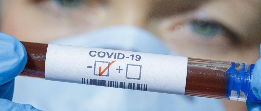 Das RKI spielt eine entscheidende Rolle beim Kampf gegen das Coronavirus (Symbolbild).