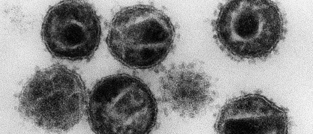 Elektronenmikroskopische Aufnahme mehrerer HIV-Erreger.