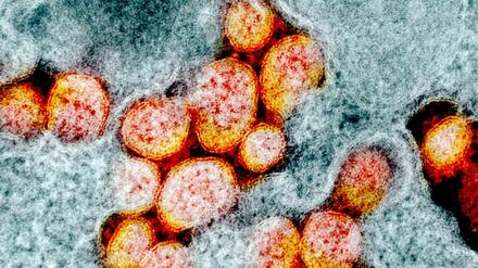 Eine Mikrografie von SARS-CoV-2 Partikeln, auch bekannt als Coronavirus.