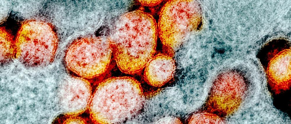 Eine Mikrografie von SARS-CoV-2 Partikeln, auch bekannt als Coronavirus.