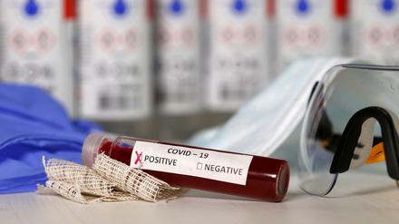 Rund vier Prozent aller Coronavirus-Tests in Berlin sind positiv. 